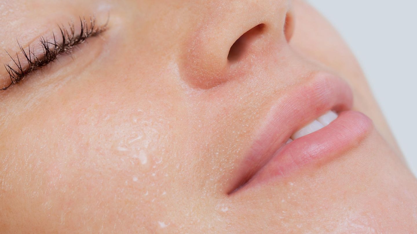 Open pores – this is how you get rid of blackheads!
+2023