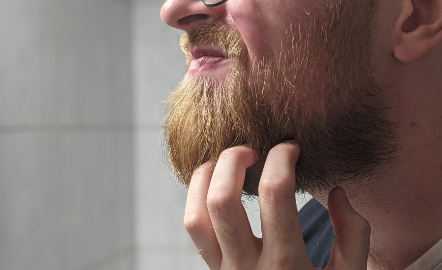 The beard itches?  Causes & 7 tips that really help
+2023