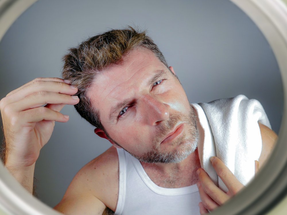 Proven Hair Loss Treatments You Can Trust To Renew Your Hair

+ 2023