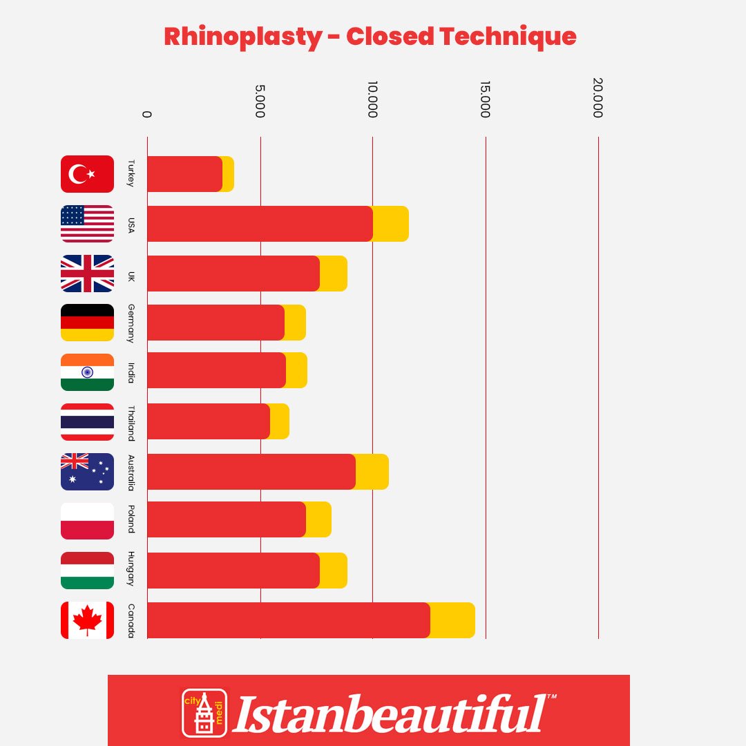 Closed Rhinoplasty price comparison chart by top countries