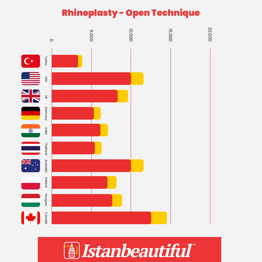 Open Rhinoplasty price comparison chart by top countries
