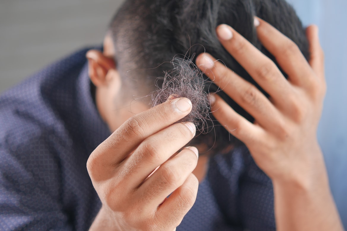 How to Identify Early Symptoms of Hair Loss?

+ 2023